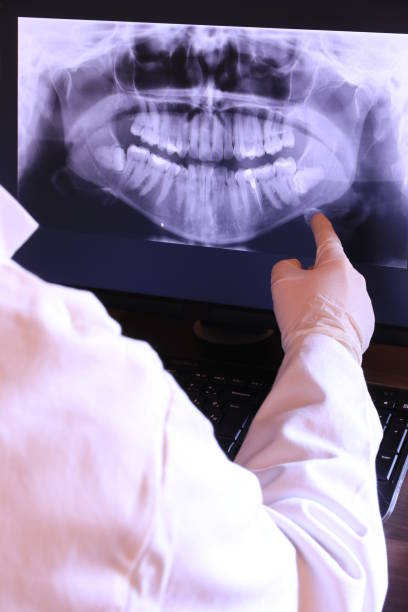 Best Emergency Root Canal Treatment in Plains, TX