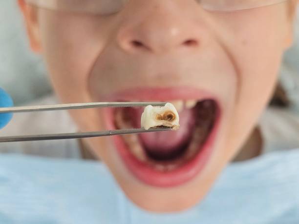 Best Emergency Orthodontic Repairs in Plains, TX